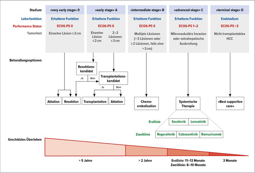 Einteilung und Therapie des HCC gemäss den «Barcelona Clinic Liver Cancer (BCLC)»-Kriterie