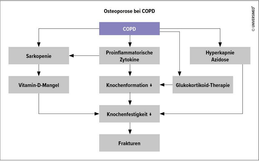 Pathophysiologie der Osteoporose bei COPD