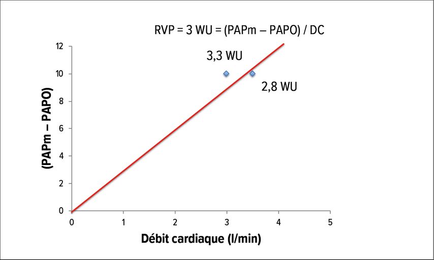 Importance de la fiabilité de la mesure du débit cardiaque sur le diagnostic