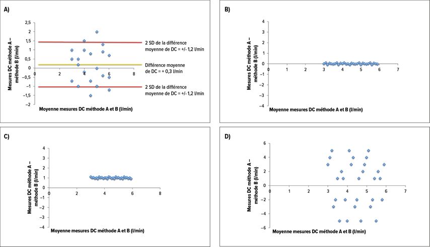 Exemple d’interprétation du graphique de Bland et Altman comparant deux méthodes de mesures du débit cardiaque