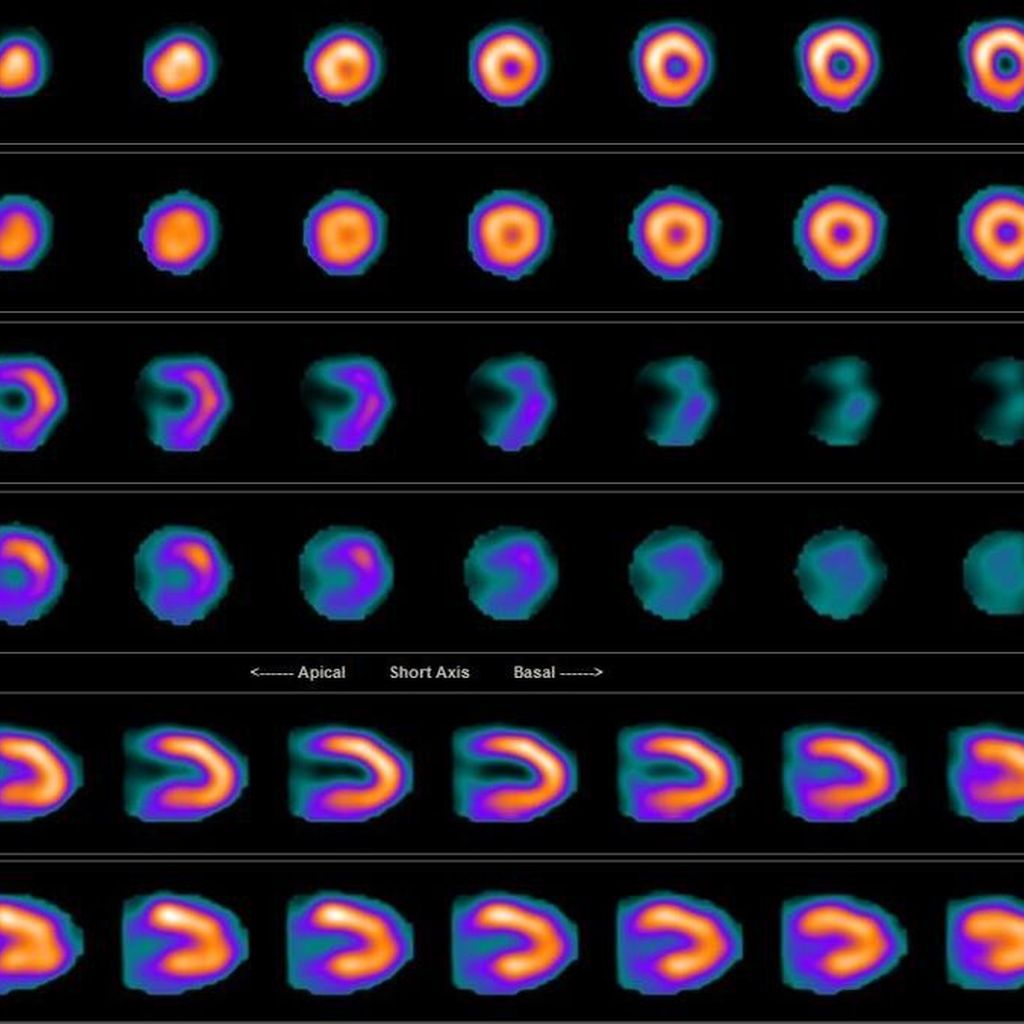  Kardiologie & Gefäßmedizin Universimed Medizin im Fokus