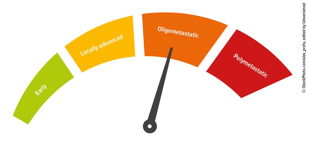 Evolving concepts in oligometastatic head and neck cancer - Onkologie ...