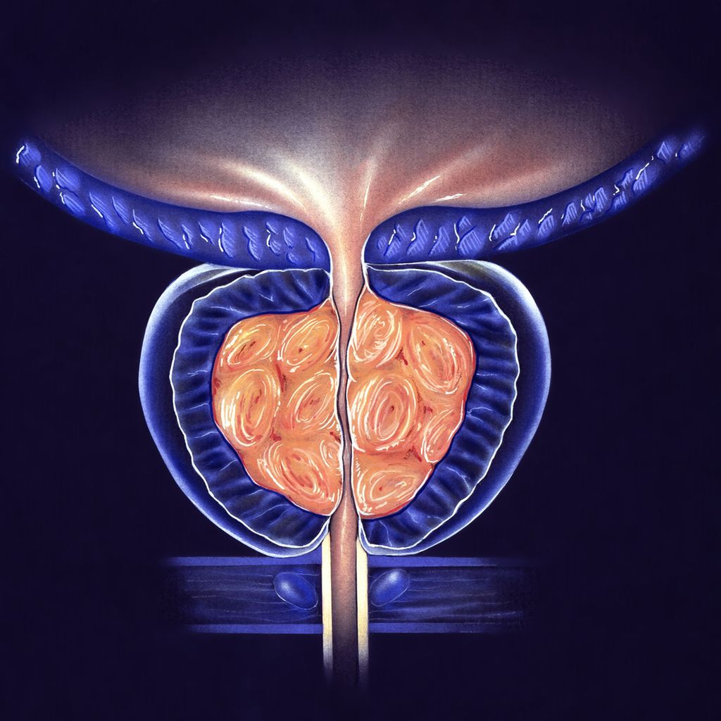 Endoskopische Prostataenukleation Goldstandard Ab 100 Ccm Urologie endoskopische-prostataenukleation-goldstandard-ab-100-ccm-urologie
