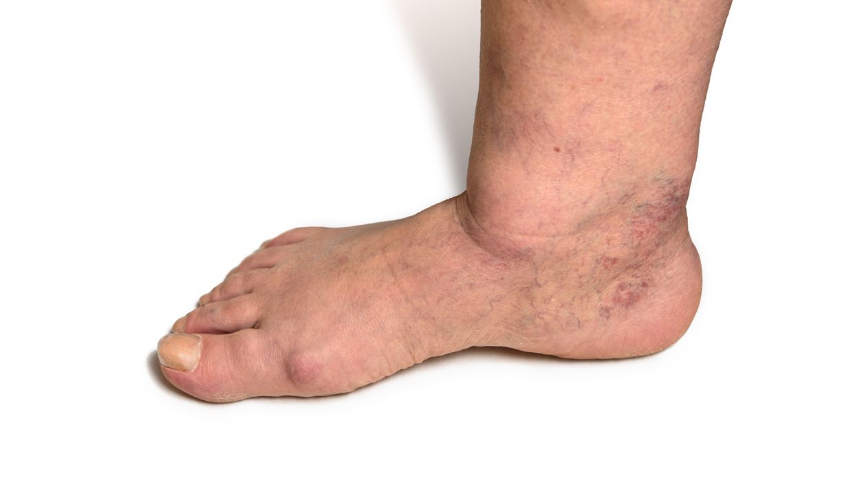 30 Von 100 Euro 30 Von 100 Euro