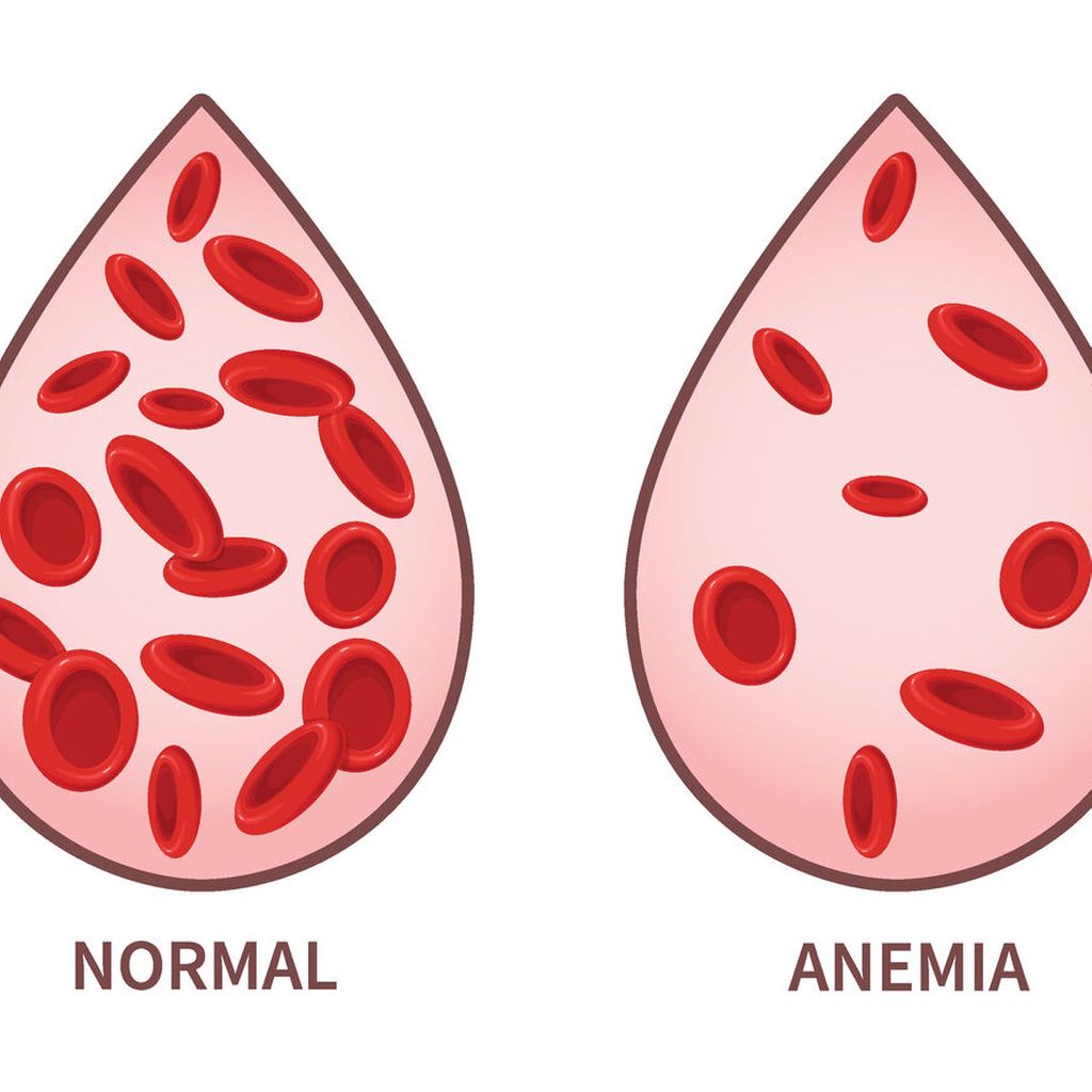 Unklare chronische Anämie, wie weiter? Hämatologie Universimed