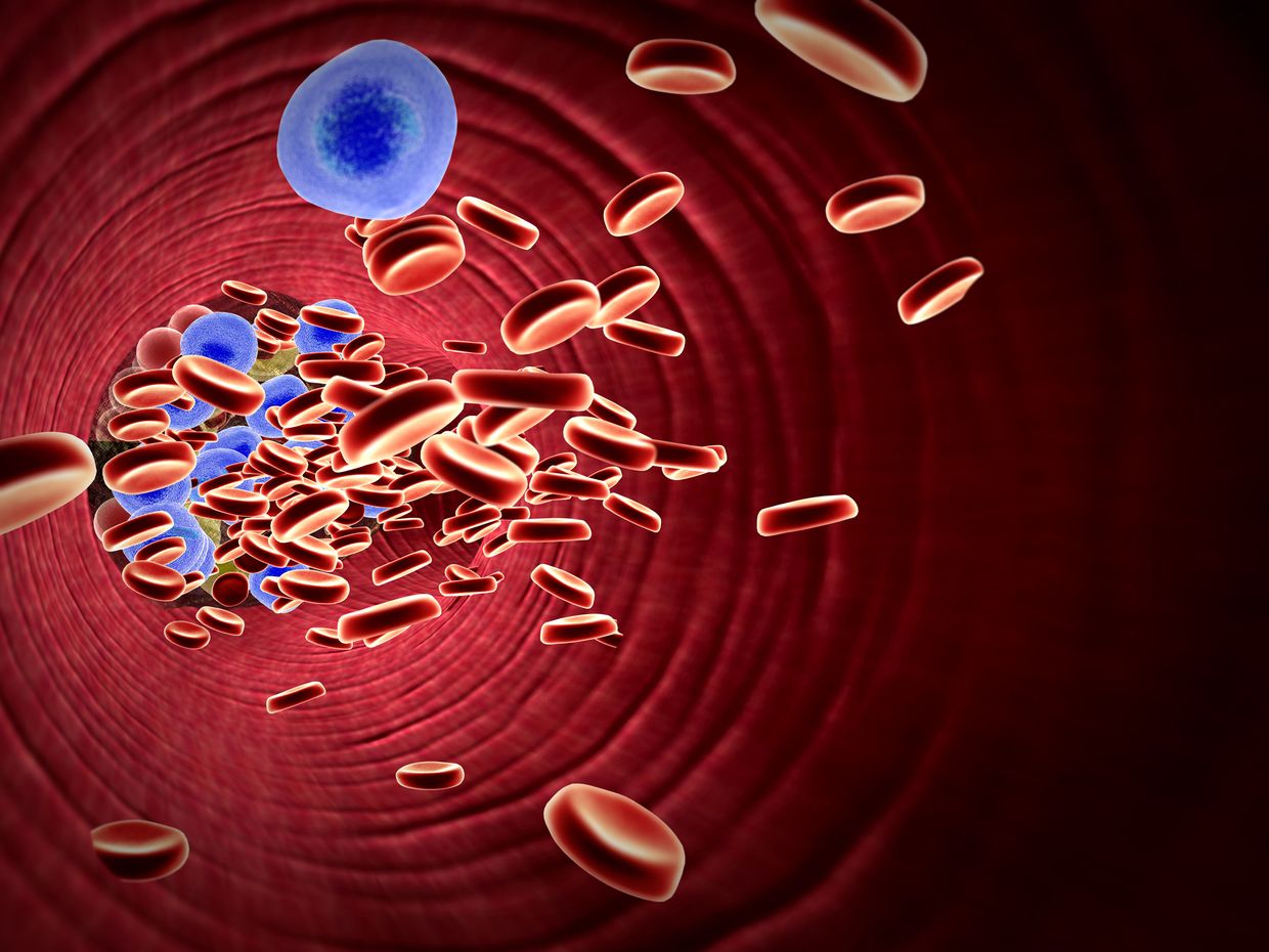 Niedervoltage Diagnostik Und Ursachen Kardiologie Gefassmedizin Universimed Medizin Im Fokus