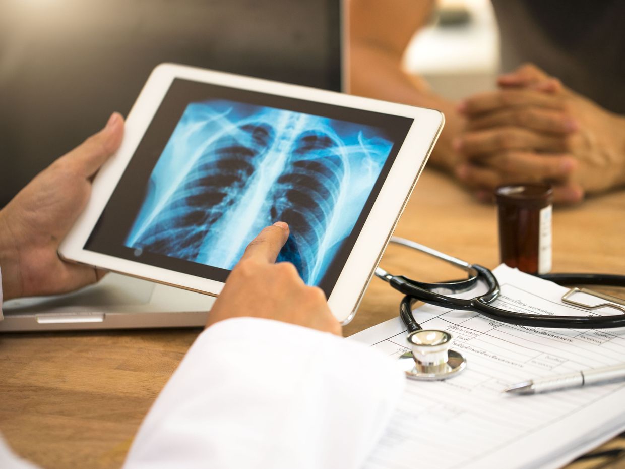 Blut im Sputum: Wann liegt ein Notfall vor? - Pneumologie ...