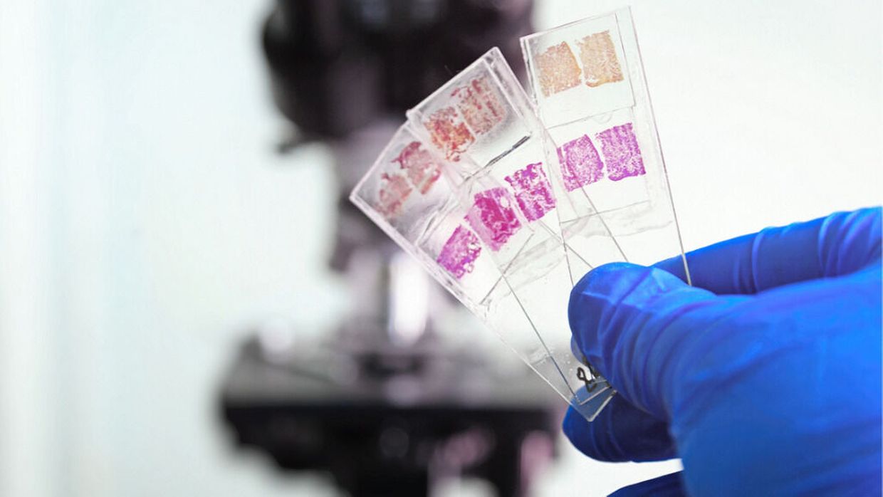 „DNA mismatch repair“ und Mikrosatelliteninstabilität Testmethoden