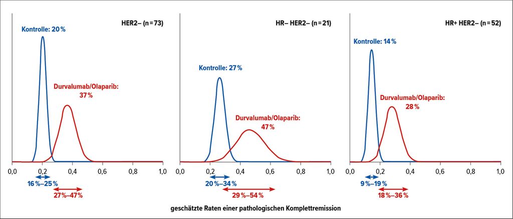 Invasives Lobuläres Mammakarzinom G2 Prognose