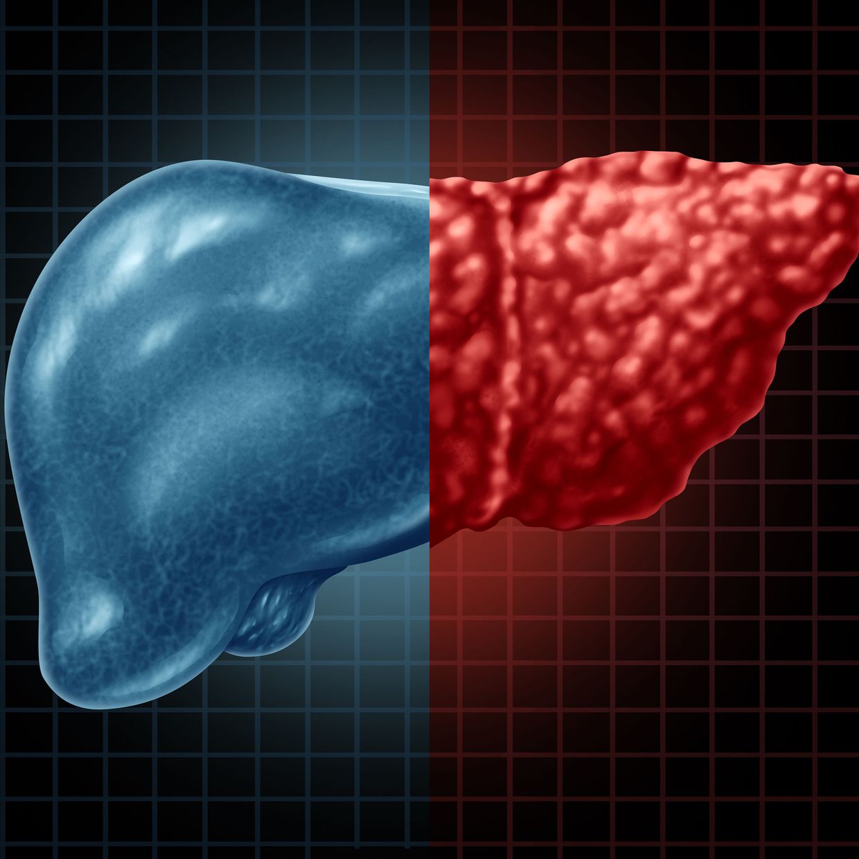 Combien De Temps Dure Une Ponction D ascite Le traitement de l'ascite et de l'hémorragie par rupture de varices œs -  Allgemeine Innere Medizin - Universimed - Medizin im Fokus