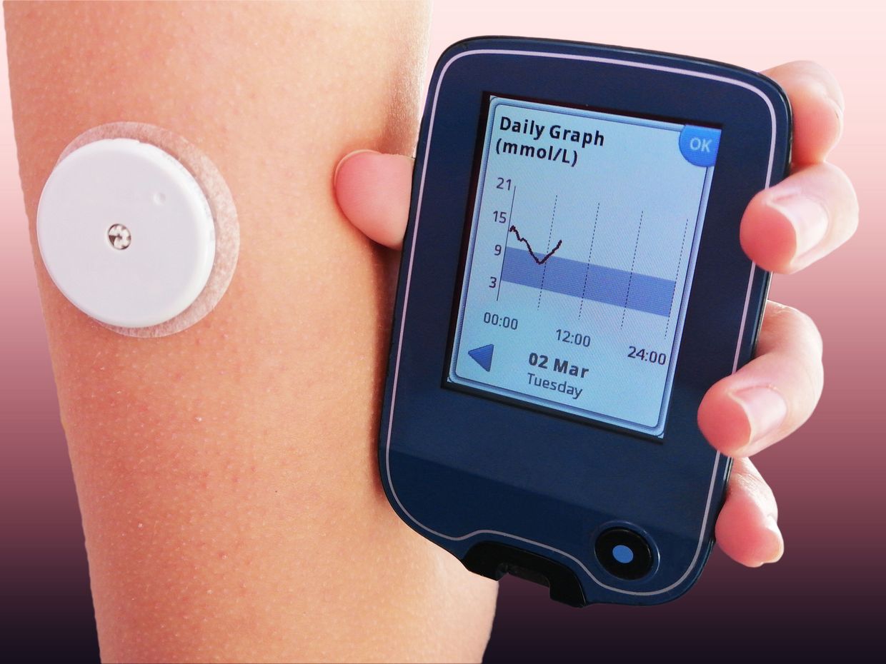 Eversense : le 1er système implantable mesurant la glycémie en continu -  Diabète & Nutrition