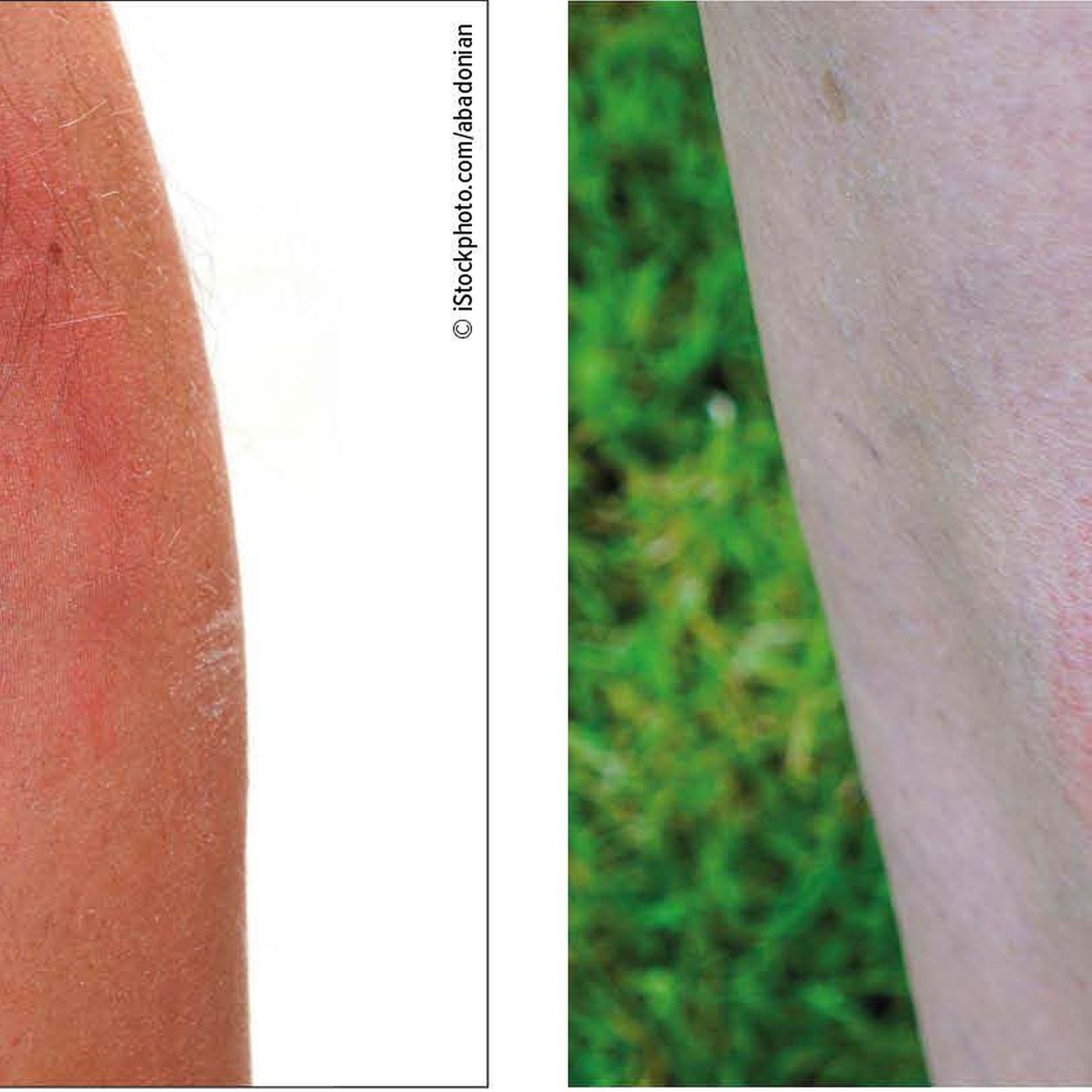 30 Wege, wie Urispas 200 mg Kaufen günstig zollfrei Bestellung Sie unbesiegbar machen kann