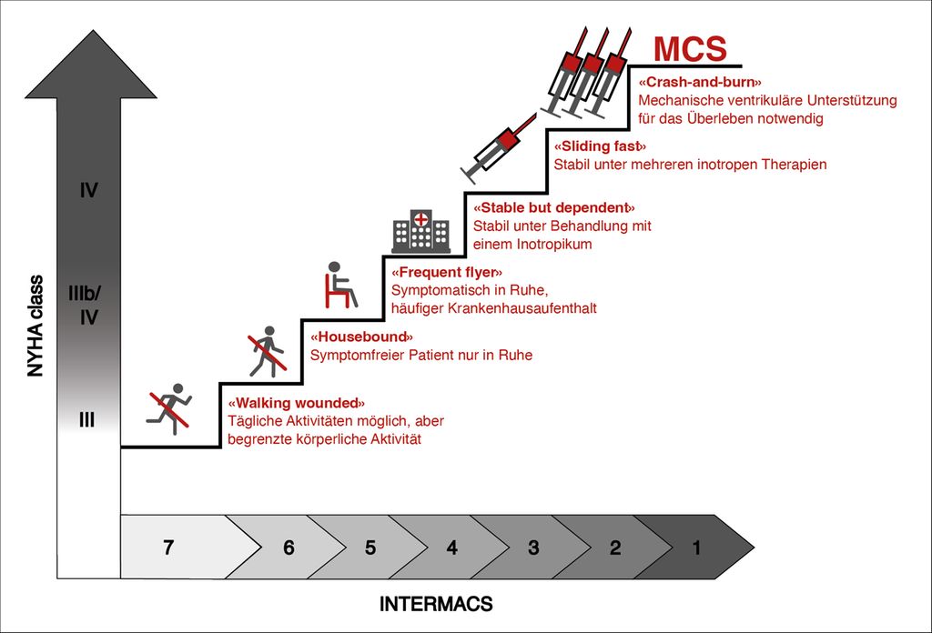 Fortgeschrittene Therapie der Herzinsuffizienz: Warum und wie ...