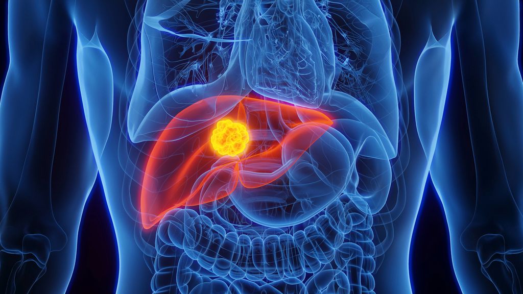 Antikoagulation bei Vorhofflimmern - Kardiologie & Gefäßmedizin