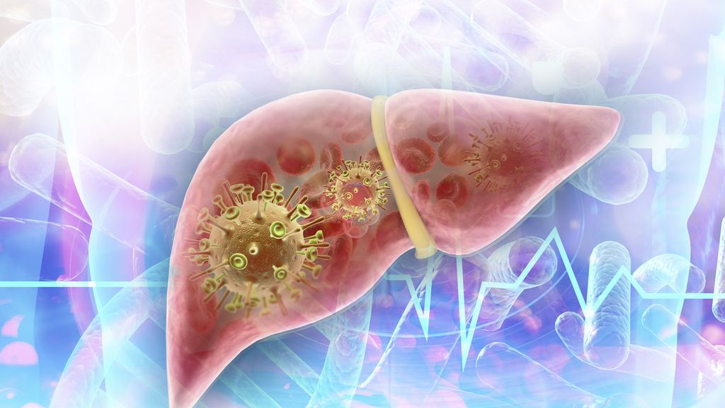 Nichtalkoholische Pankreaslipomatose Und Fettlebererkrankung Two Of A Kind Hepatologie Universimed Medizin Im Fokus