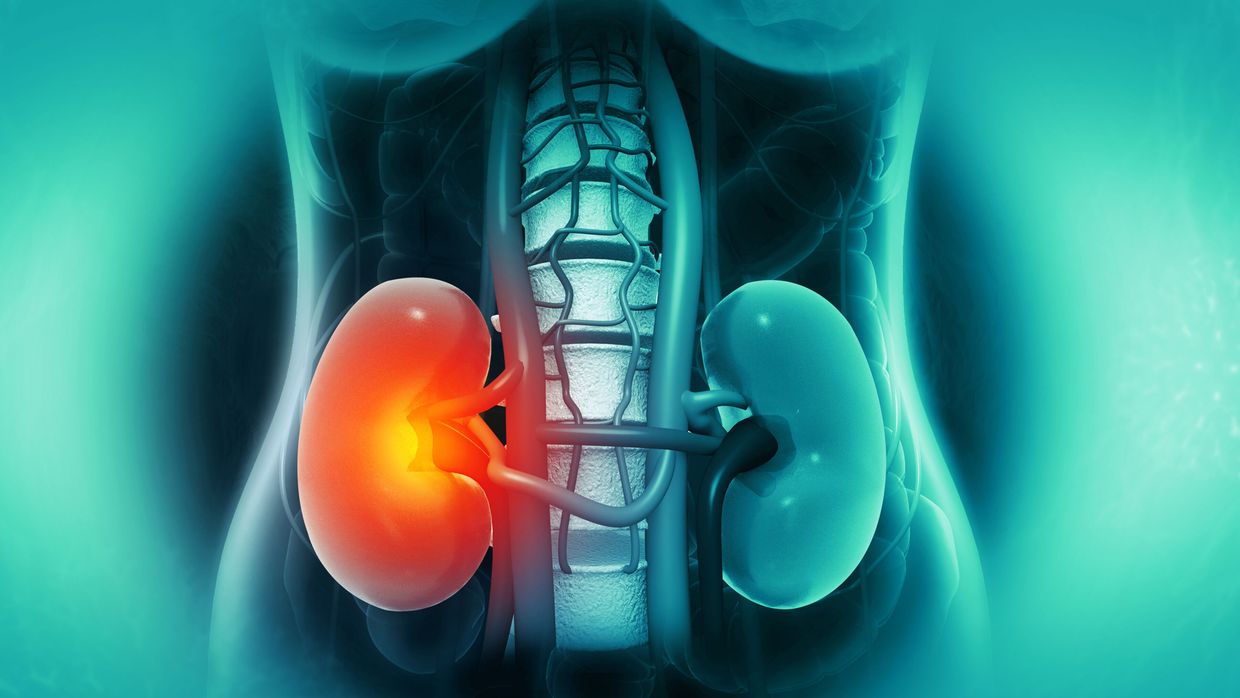 Frühe, aggressive Therapie ist entscheidend Rheumatologie