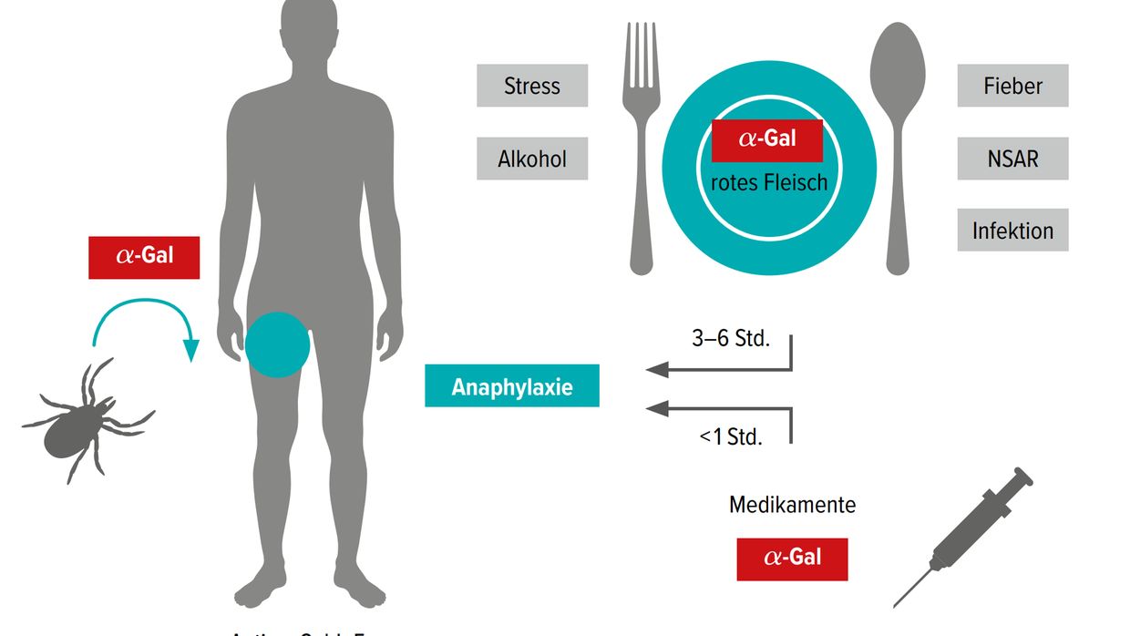 Wenn Steak und Co. gefhrlich werden - Dermatologie - Universimed -  Knowledge that matters