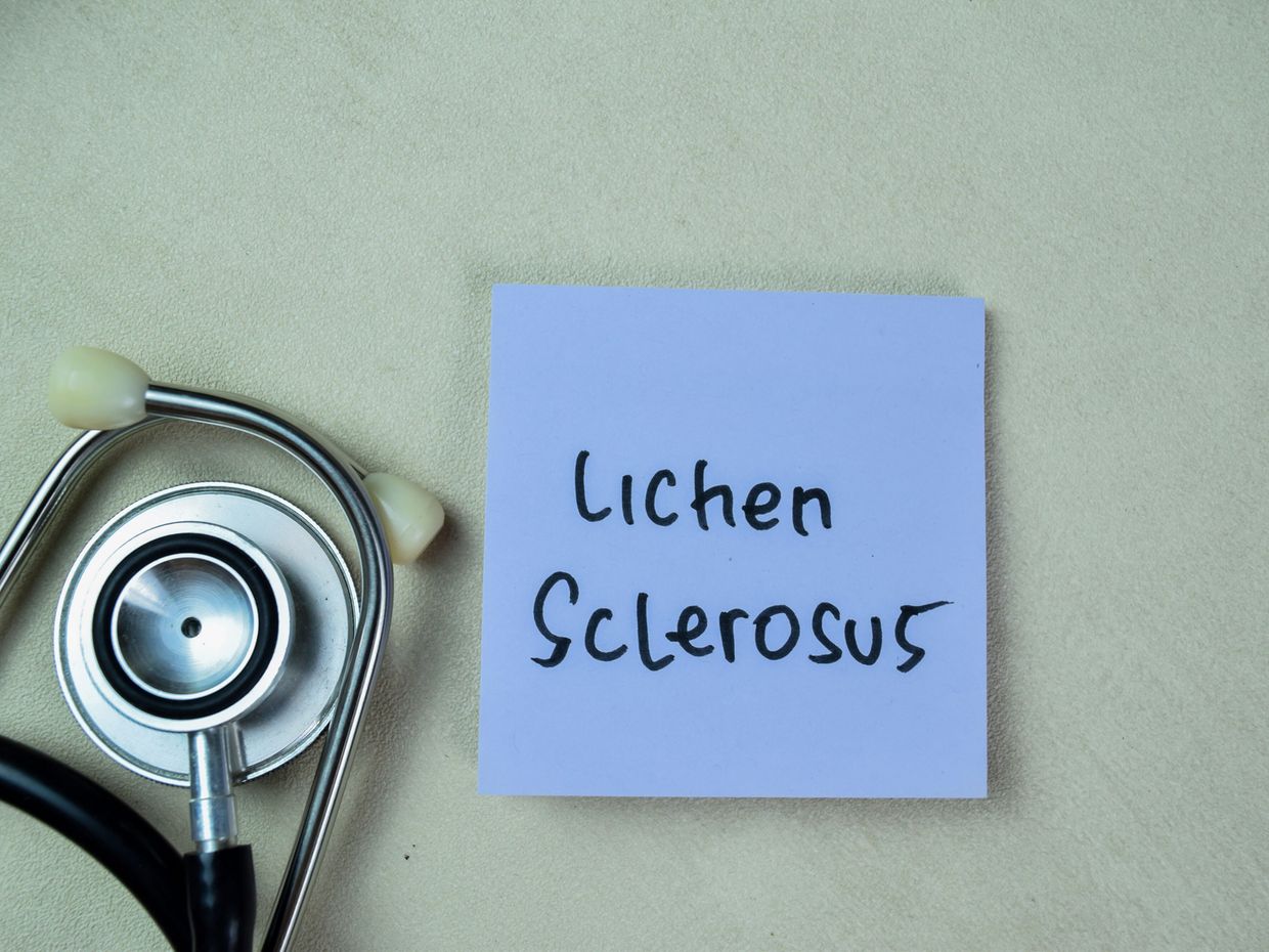 Lichen sclerosus et atrophicans im Kindesalter - Dermatologie - Universimed  - Knowledge that matters