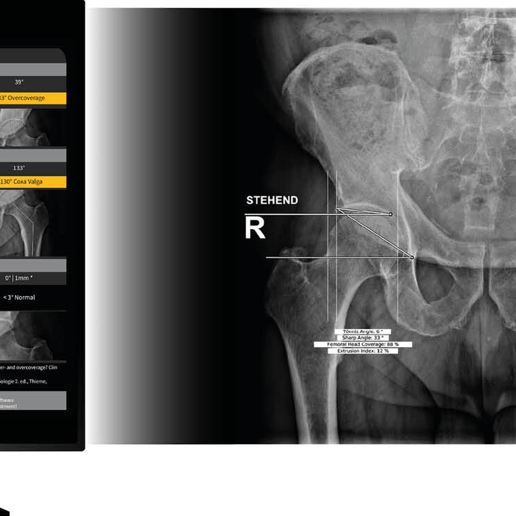 Artificial Intelligence in der Bildgebung des Bewegungsapparates ...