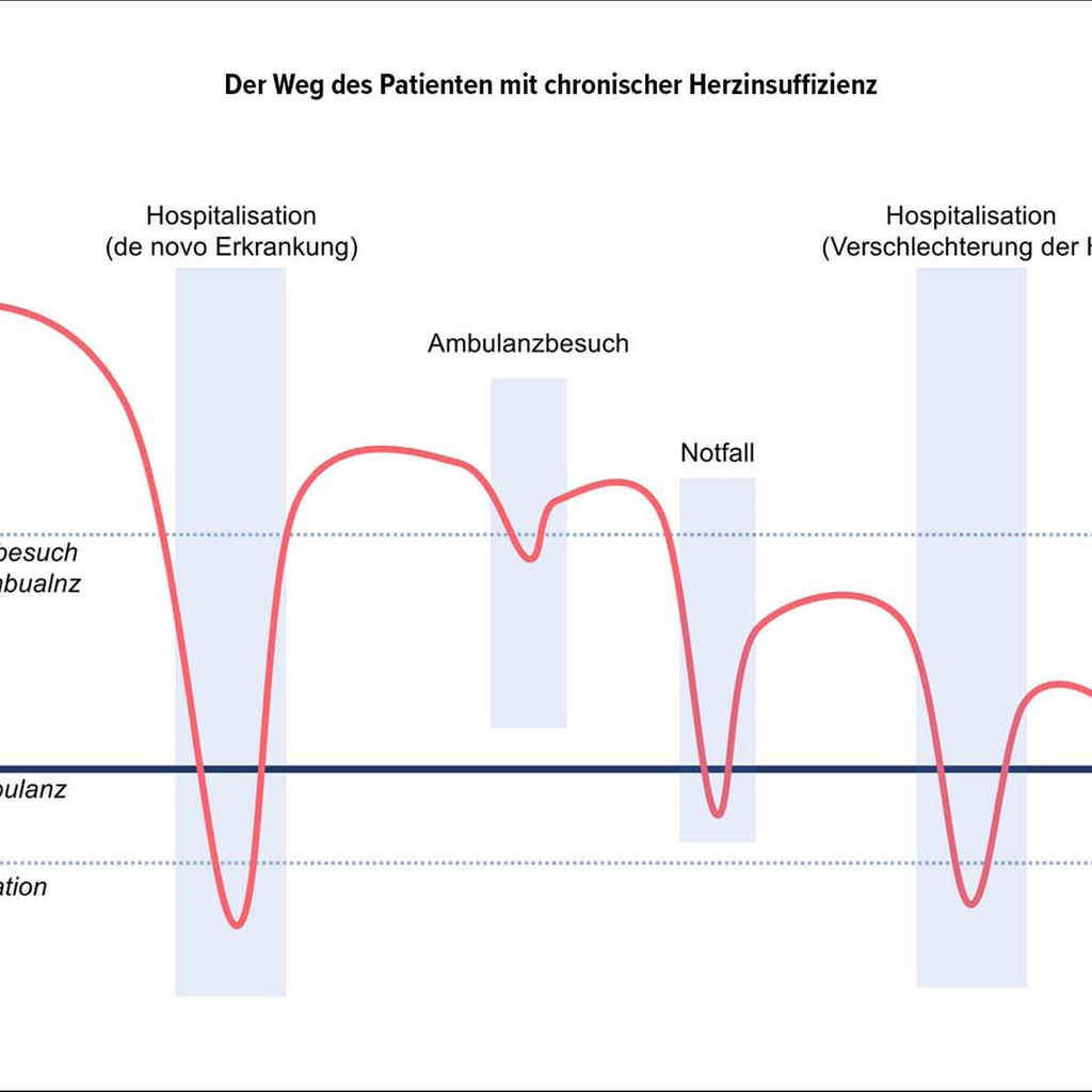 Akute Herzinsuffizienz: Appell des Herzens für bewährte Therapien der - Kardiologie ...