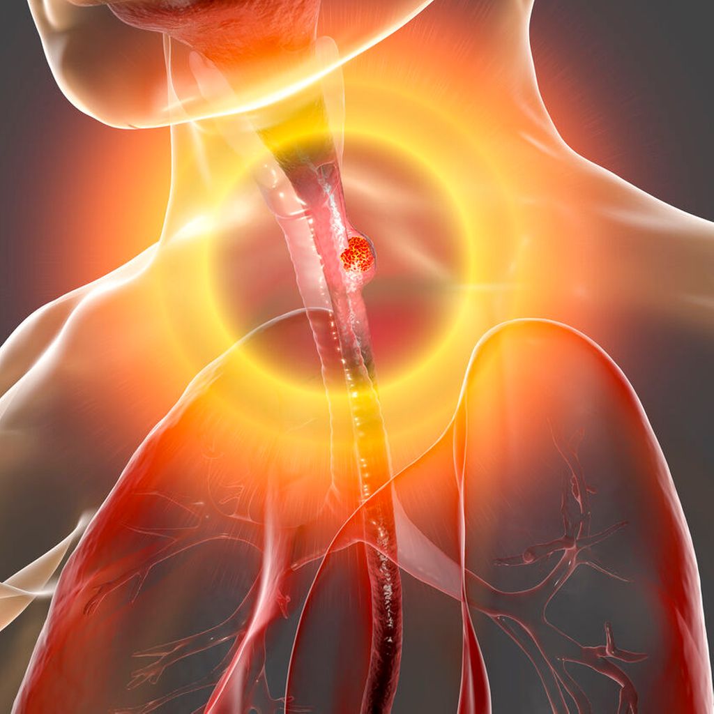 neue-standard-erstlinienoptionen-mit-nivolumab-haltigen-regimen