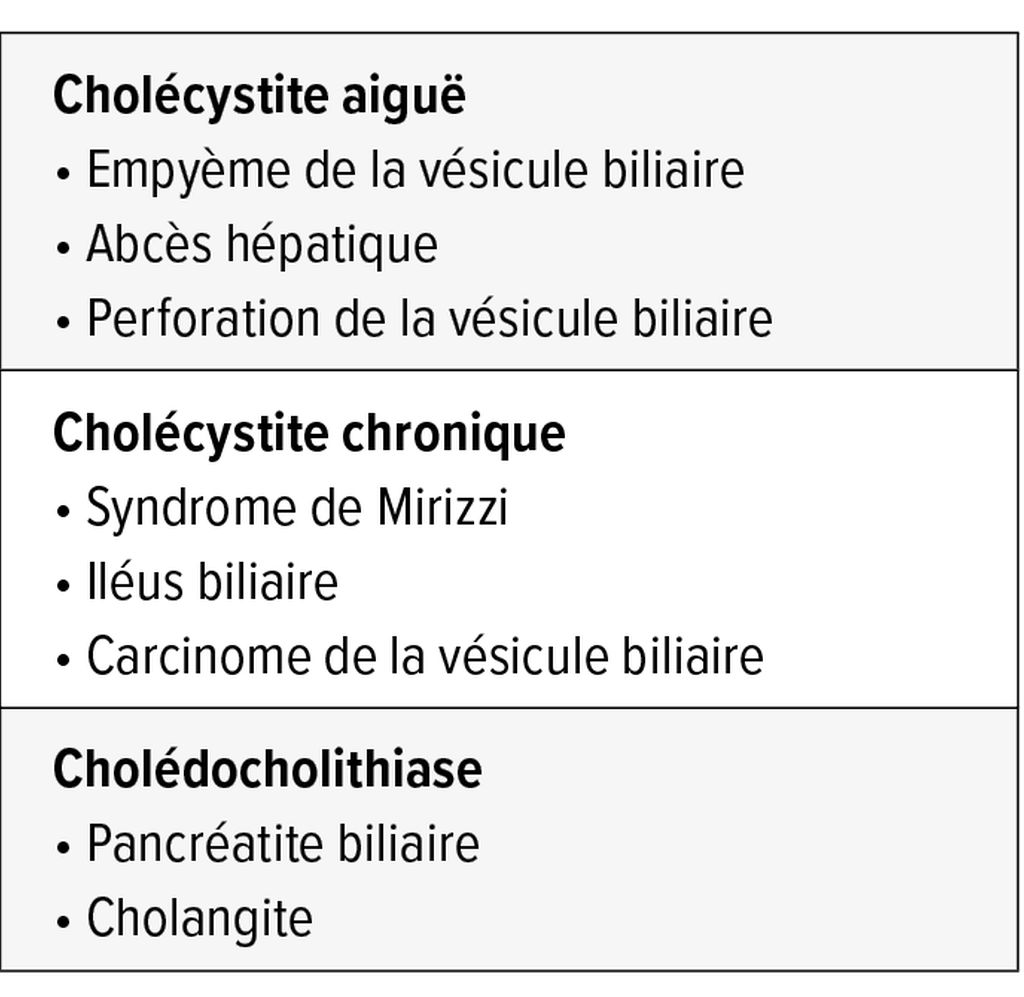 Diagnostic et traitement de la lithiase biliaire - Médecine interne