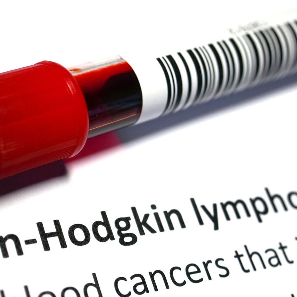 Copanlisib plus Rituximab ist eine effektive und sichere Therapieoptio ...