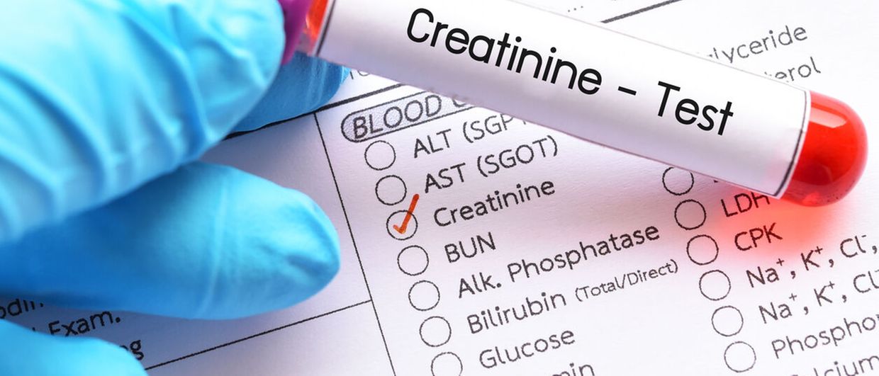 Das Erhohte Kreatinin Wann Und Wie Abklaren Allgemeine Innere Medizin Universimed Medizin Im Fokus