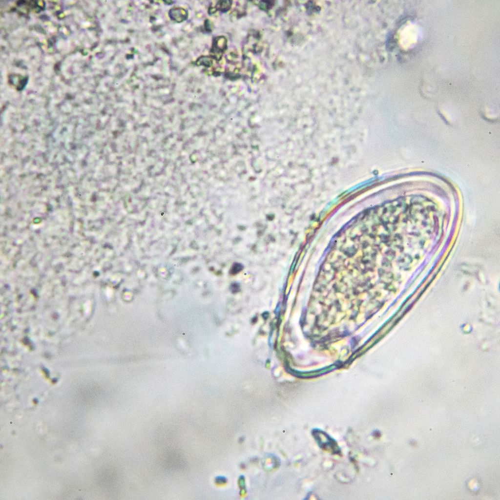 oxyuren-und-was-man-dagegen-tun-kann-infektiologie-universimed