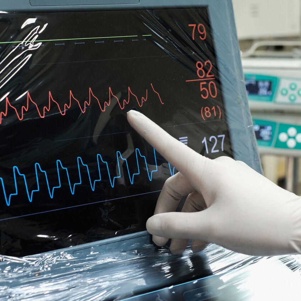 Neue Ambulanz für intensivmedizinische Universimed