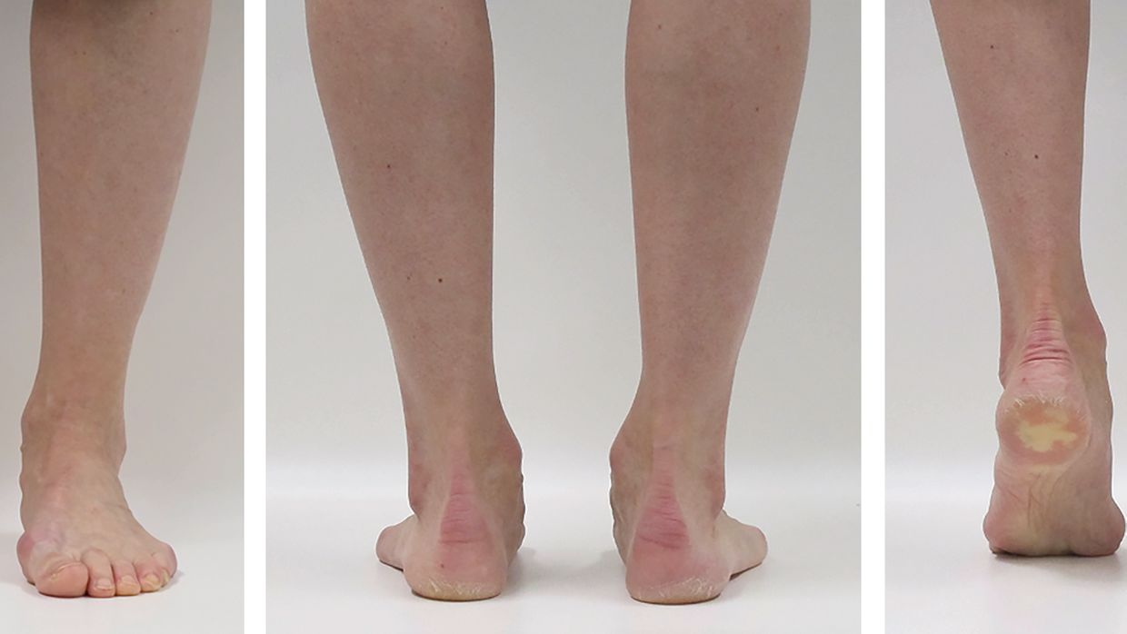 külot kiygan lezbiyenler Teri shim kiygan qizlar fotosurati