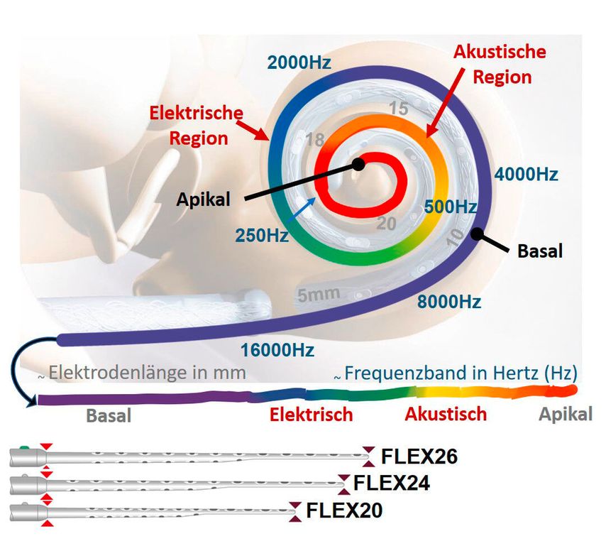 Farblich dargestellt sind der Frequenzbereich bzw. das Frequenzband (Hz) (blaue Schrift) und die Elektrodenlänge (mm) (graue Schrift) innerhalb der Cochlea