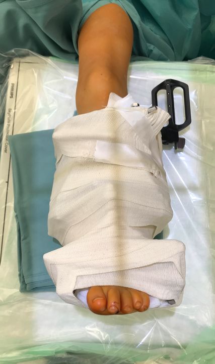 Der „Beacon“ ermöglicht einerseits die Kalibrierung und andererseits die automatische Detektion der Mounting-Parameter.