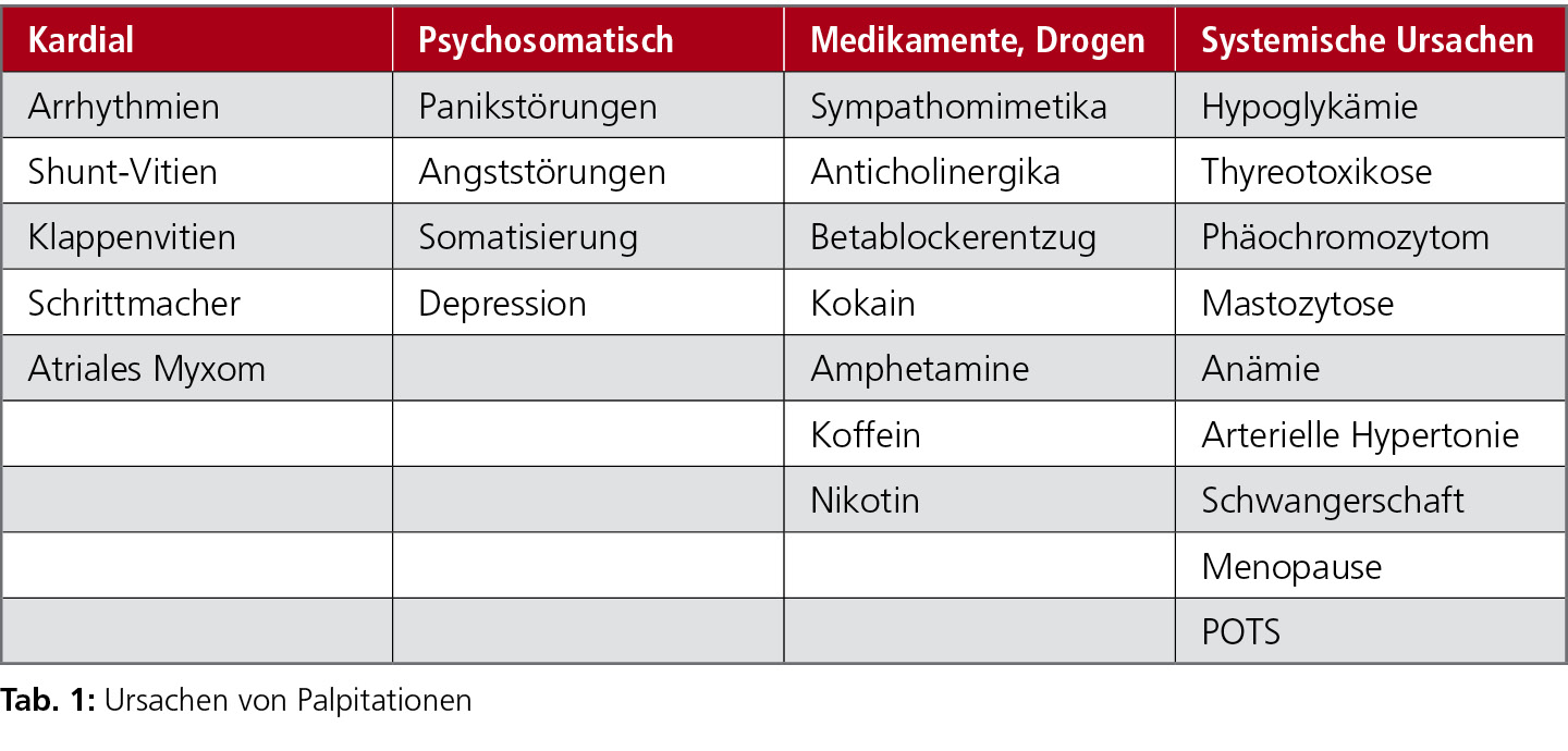 Rationale Abklarung Von Palpitationen Kardiologie Gefassmedizin Universimed Medizin Im Fokus