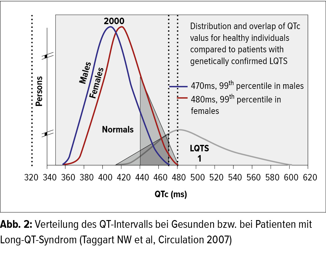 Long Qt Syndrom Grad Der Behinderung