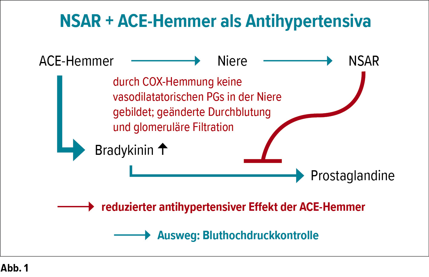 Die Bedeutung Der Nsar In Der Schmerztherapie Neurologie Universimed Medizin Im Fokus