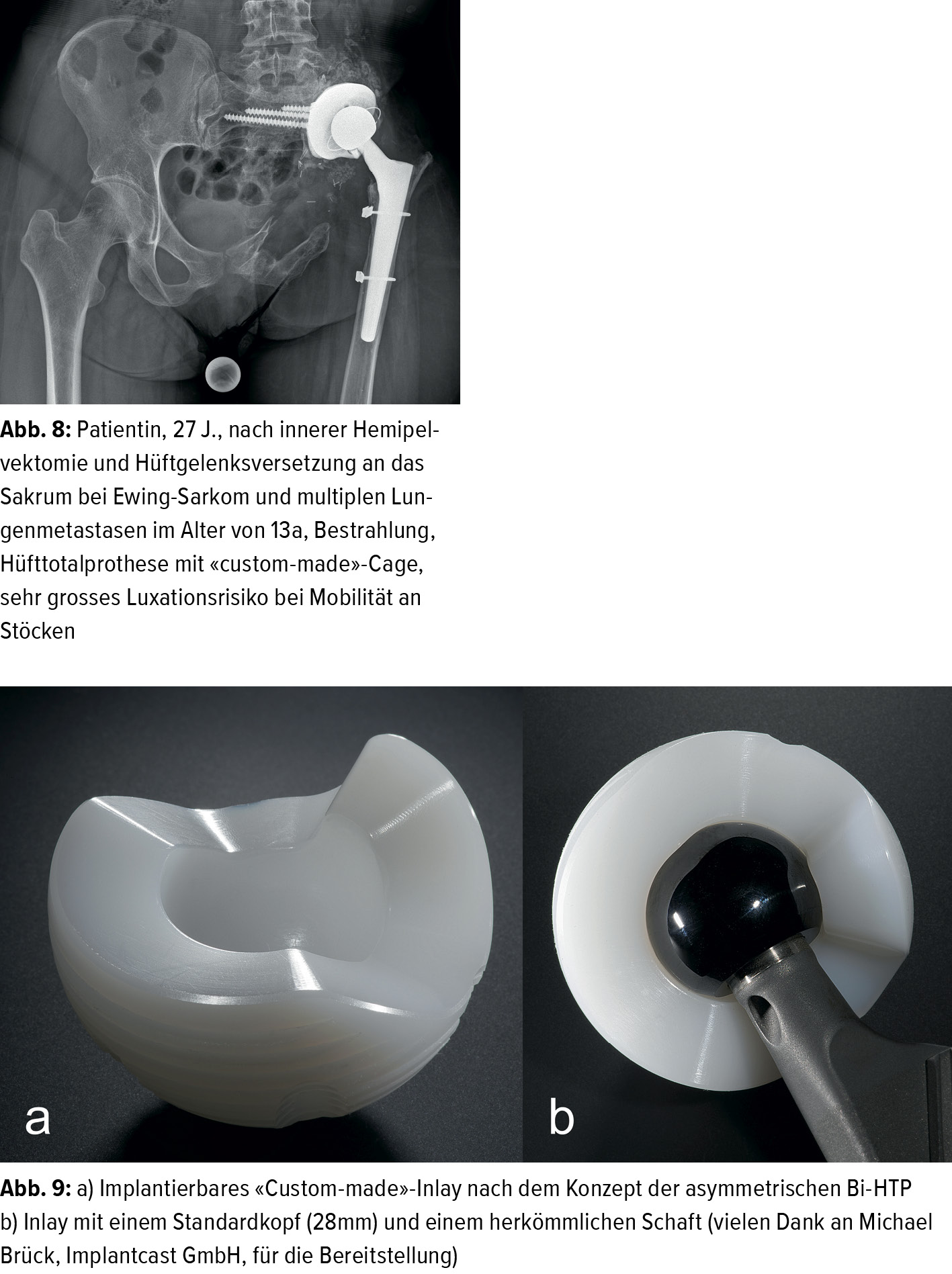 Hufttotalendoprothetik In Der Heutigen Zeit Gut Genug Orthopadie Traumatologie Universimed Medizin Im Fokus