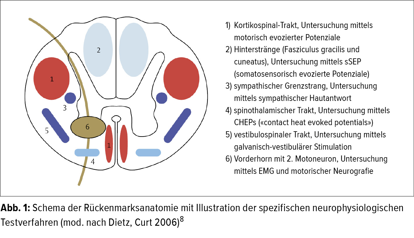 Neurologische Operationsindikation An Der Wirbelsaule Und
