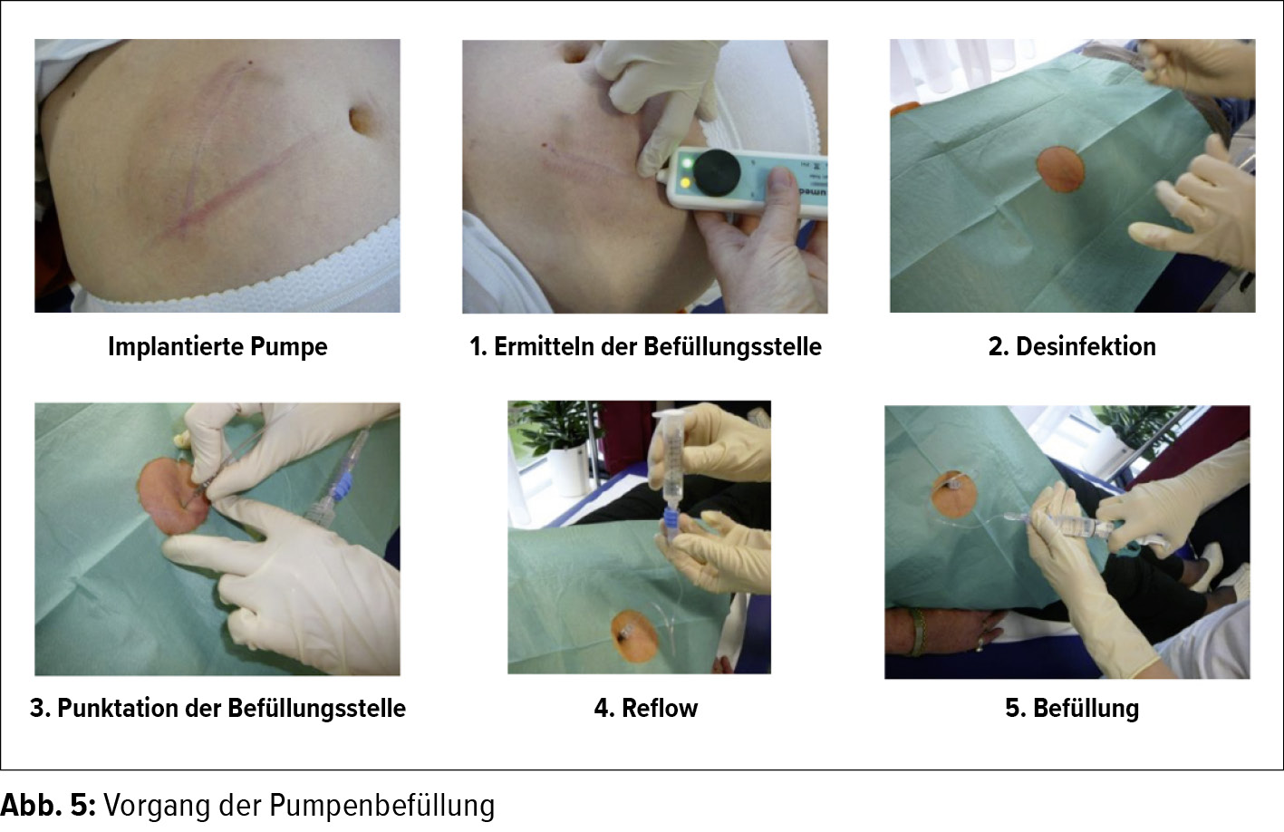Was ist im Umgang mit Lungenhochdruckpatienten zu beachten? - Kardiologie &  Gefmedizin - Universimed - Knowledge that matters