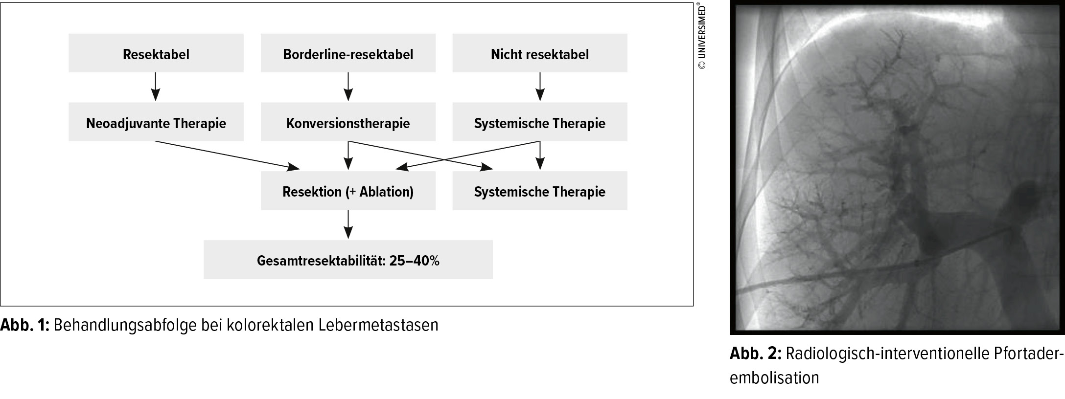 Chirurgische Möglichkeiten im interdisziplinären Therapiekonzept bei kolorektalen