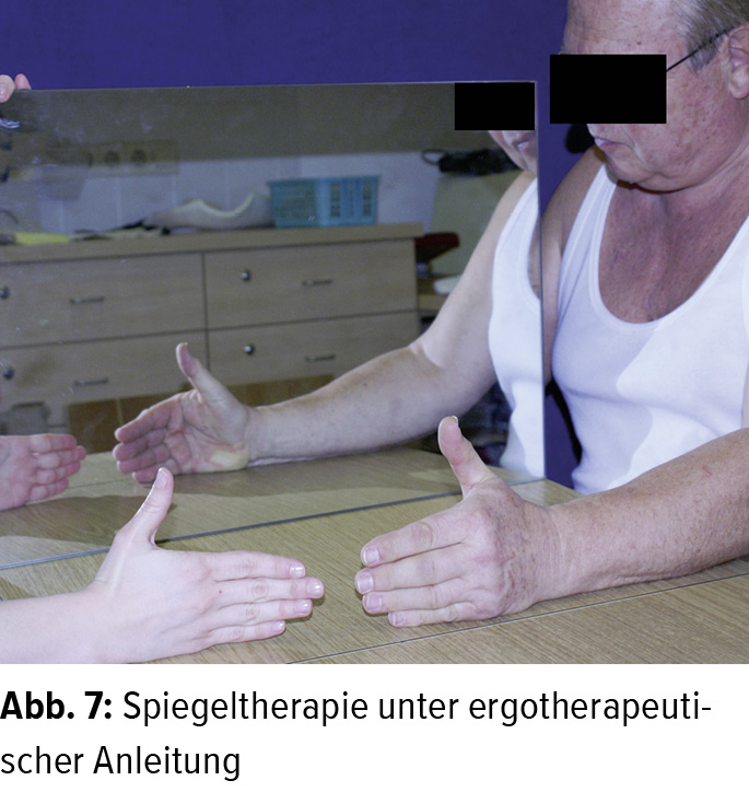 Komplexes regionales Schmerzsyndrom - Neurologie - Universimed - Medizin im Fokus