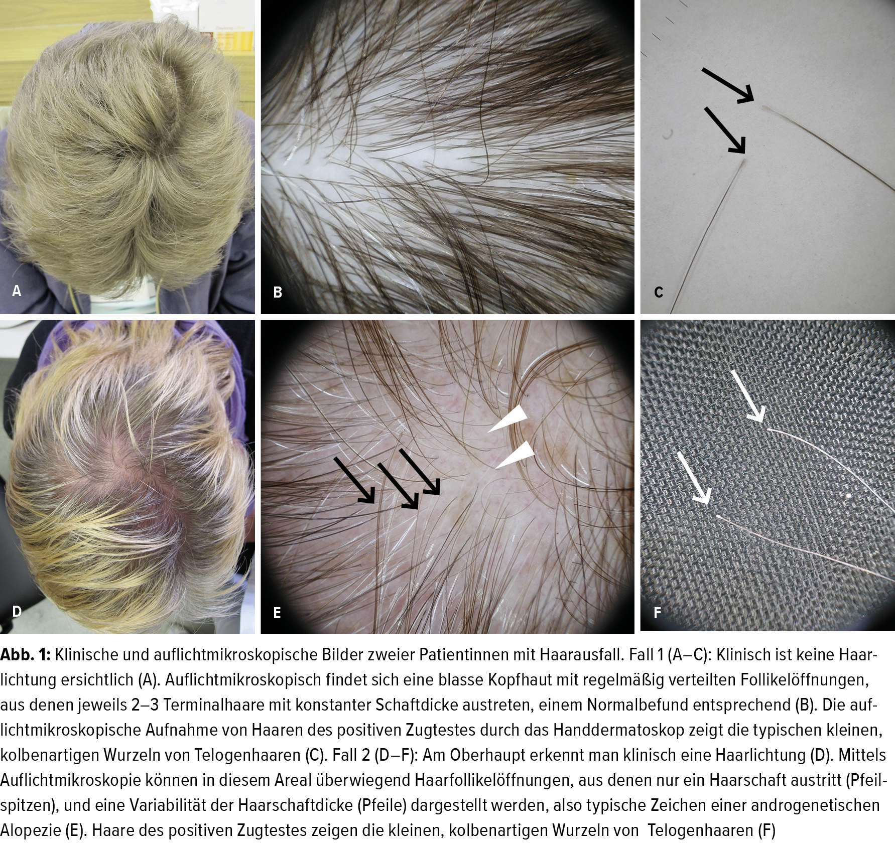 invasiven diagnostik von haar