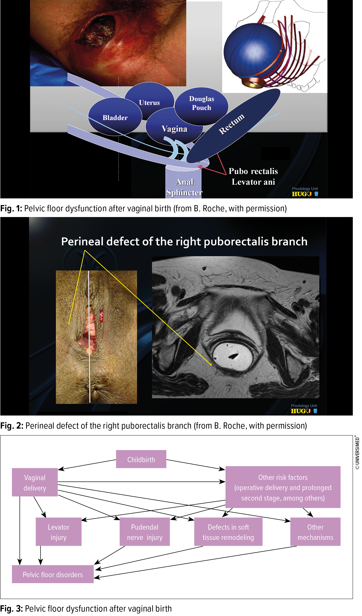 Pregnancy And Postpartum Management A New Approach Gynakologie Geburtshilfe Universimed Medizin Im Fokus It lies between the thighs, and is separated from the pelvic cavity superiorly by the pelvic floor. pregnancy and postpartum management a