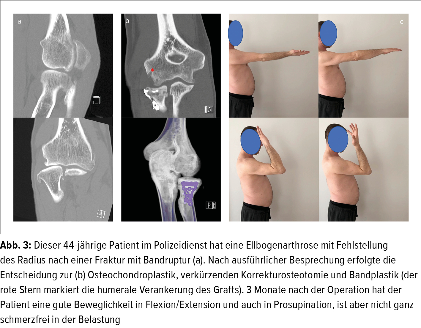 künstliche mistelzweige kaufen Kunstzweige | Künstlicher Mistelzweig main image 0